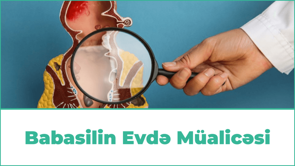 Babasilin Evdə Müalicəsi