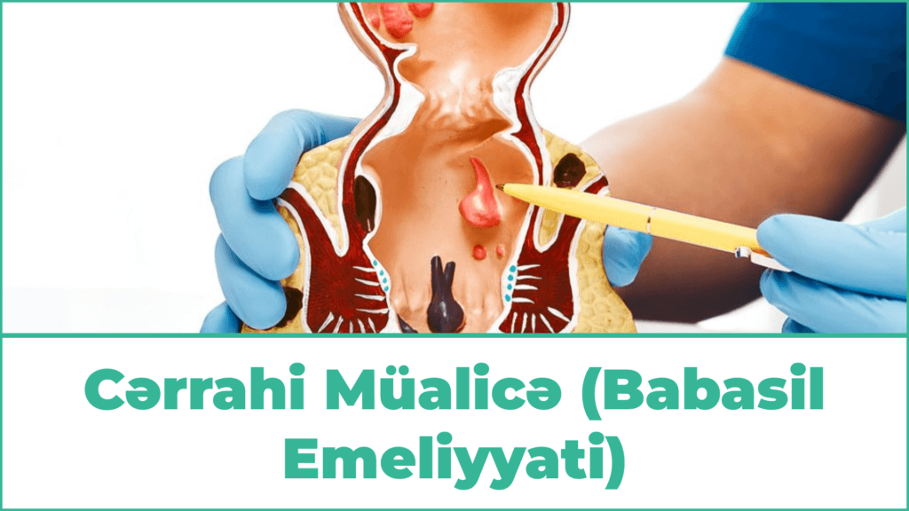 Cərrahi Müalicə (Babasil Emeliyyati)